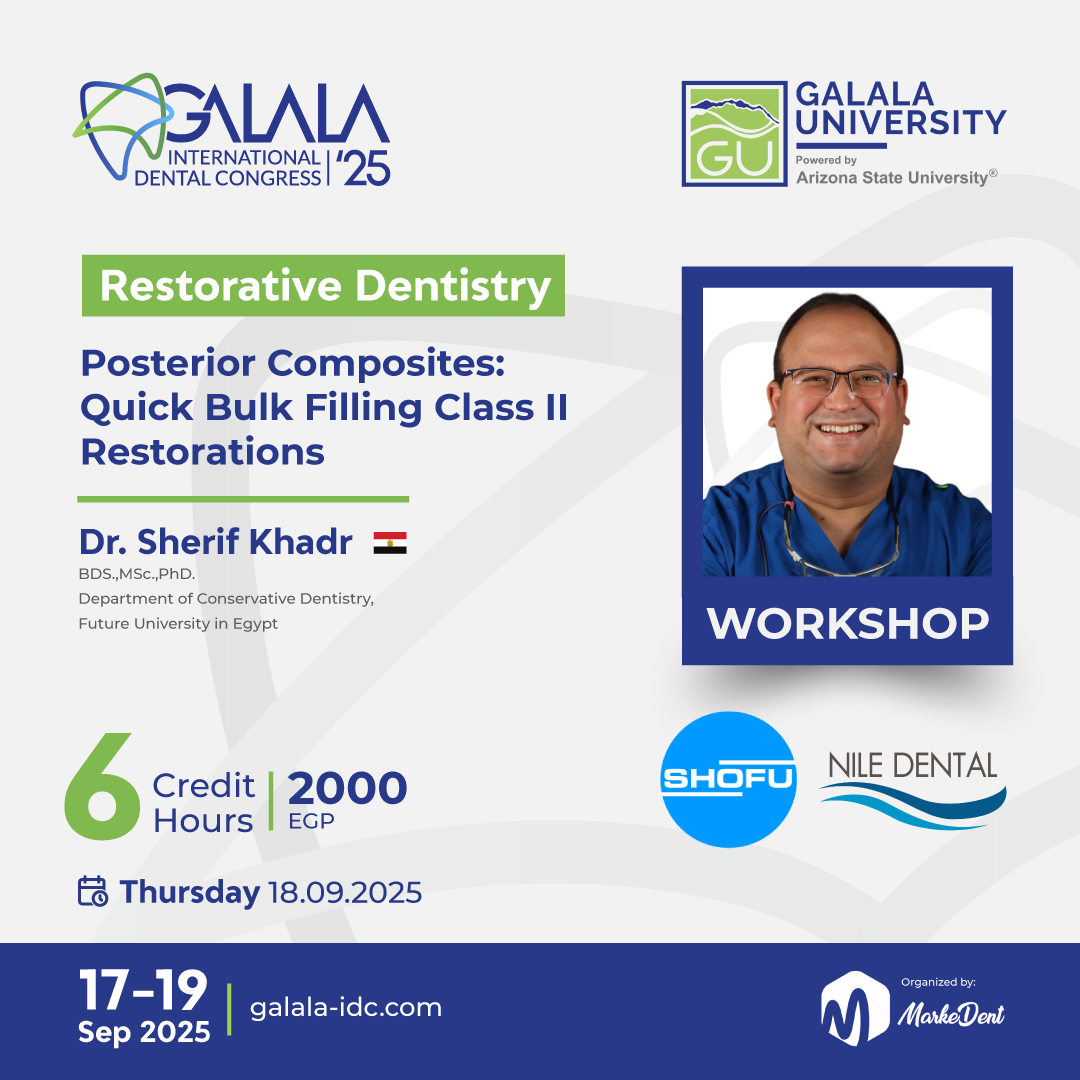 Posterior Composites: Quick Bulk Filling Class II Restorations